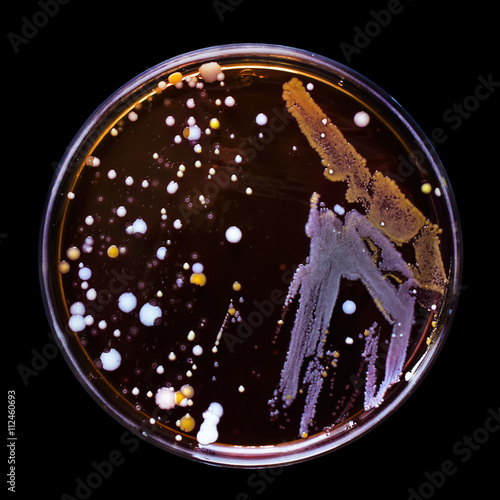 Petri dish with bacteria colonies, isolated on black