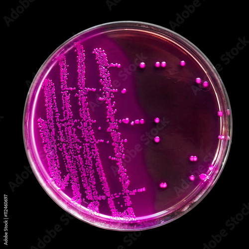 Petri dish with bacteria colonies, isolated on black