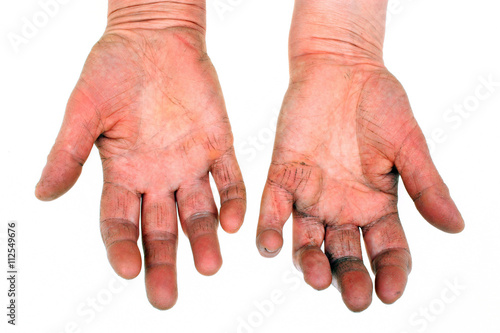 Arthritic old hands