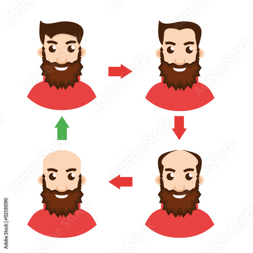 Stages Of Hair Loss