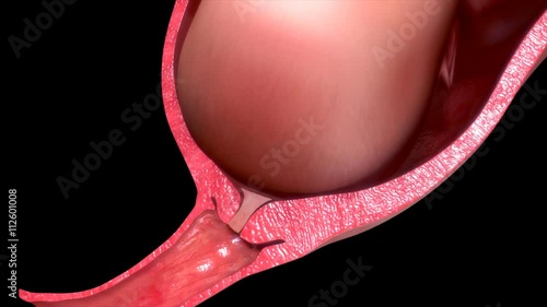 Labor and vaginal birth