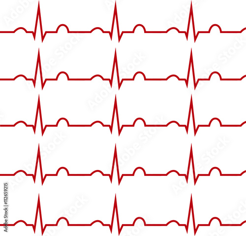 ECG on a white background, isolated