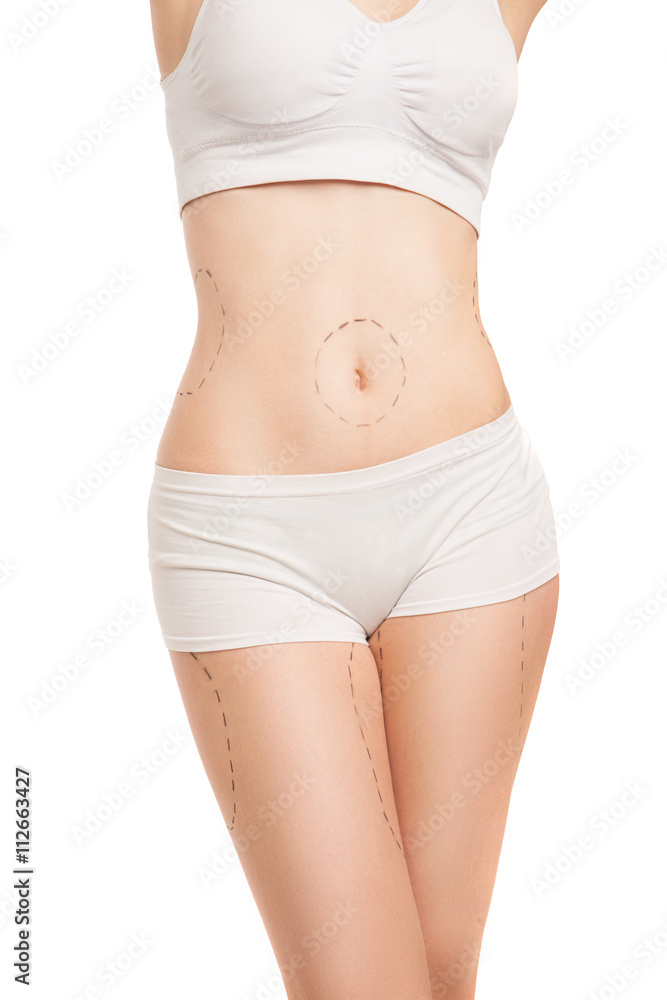 Fototapeta premium Unrecognizable woman in underwear with liposuction outlines
