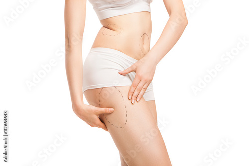 Woman with outlines for plastic surgery on body © julenochek