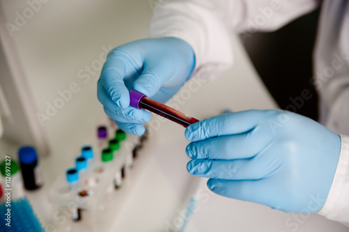 фотографія Tubes of blood and blood serum in the hands of the scientist or laboratory for a