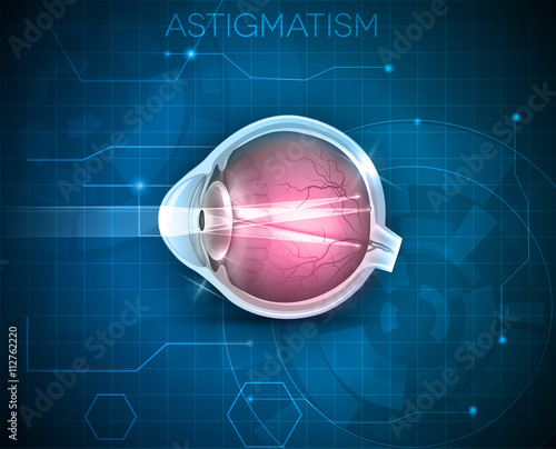 Astigmatism, eyesight problem