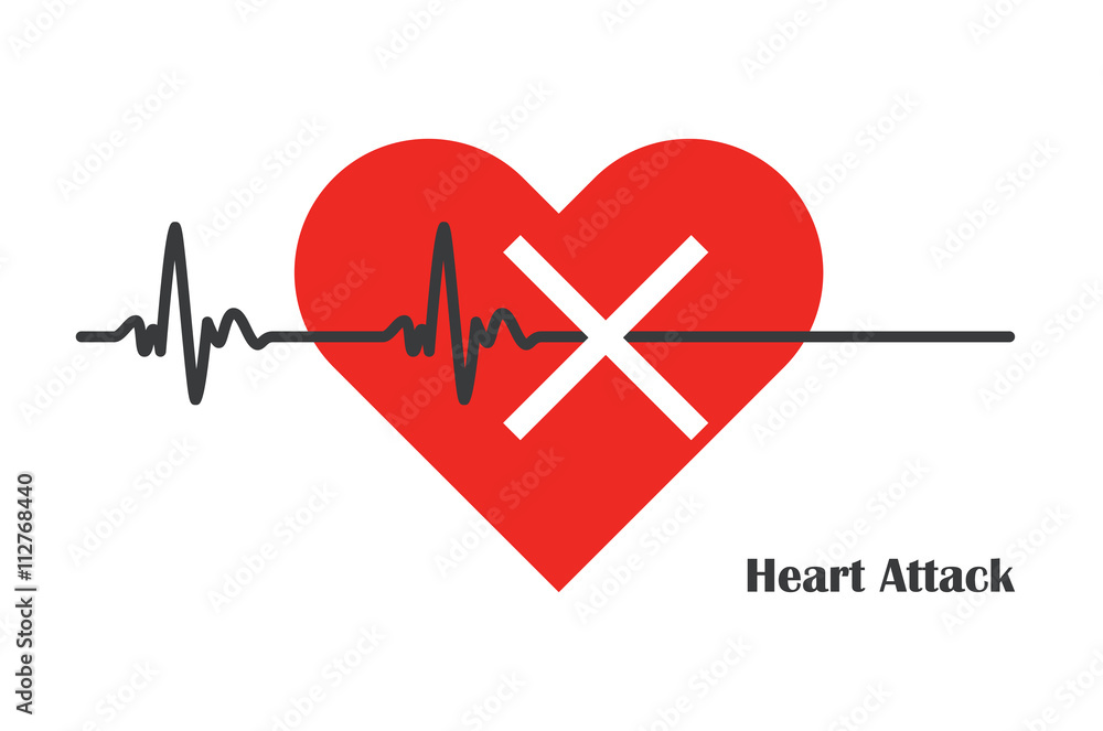 pulse rate heart attack pulse rate heart attack