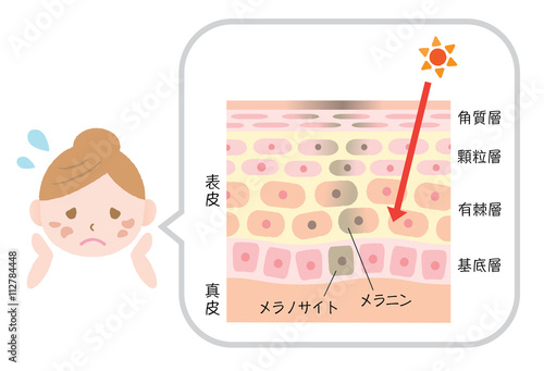 しみ　肌　女性