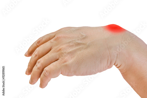 Foto Ganglion cyst