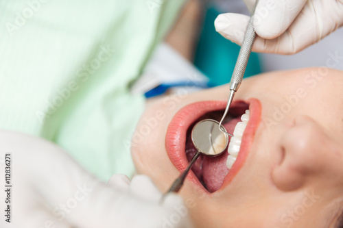 Close-up of patient open mouth during oral inspection
