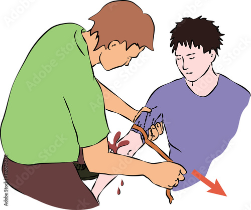First help - stop blood flow with rubber band