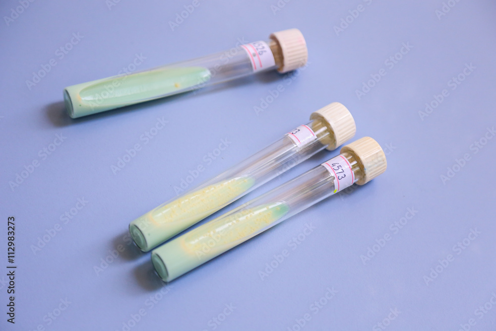 antivirus, virus, tuberculosis testing and analysis, Tajikistan antivirus, virus, tuberculosis testing and analysis, Tajikistan