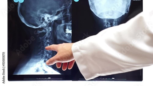 An anonymous doctor and nurse or health care specialist pointing to an x-ray of the cranium and neck of a patient.