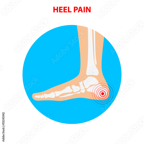 heel pain. Human ankle joint icon. Foot health care.  Vector ill