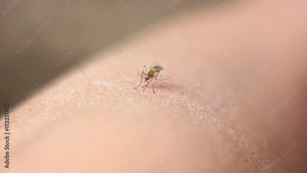 Mosquito Bite Sucking Blood the Skin Mosquito Bite Sucking Blood the Skin
