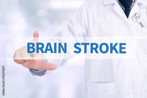 BRAIN STROKE