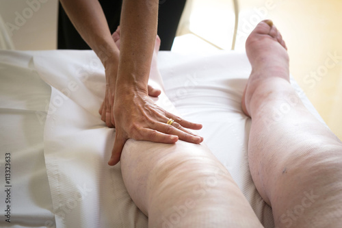 Terapista che esegue il massaggio linfodrenante  manuale su gambe con problemi di edema linfatico