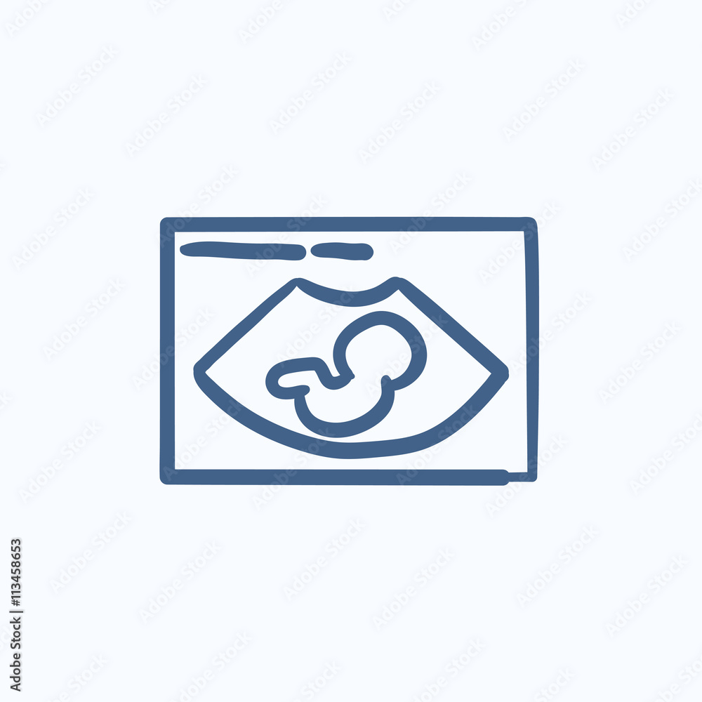 Fetal ultrasound sketch icon. Fetal ultrasound sketch icon.