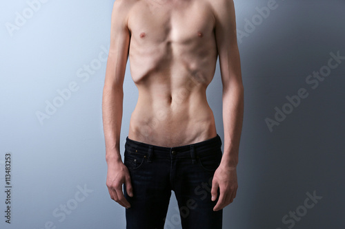 Skinny young man with anorexia on grey background