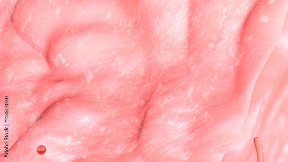 Menstruation bleeding Menstruation bleeding