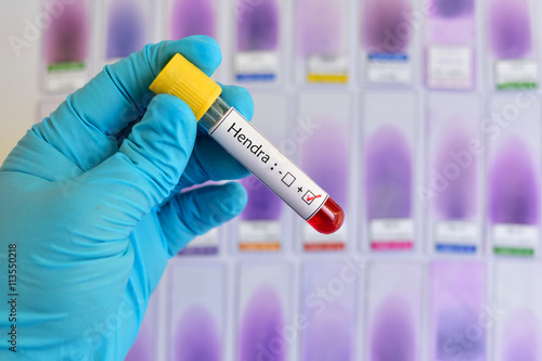 Blood sample positive with Hendra virus
