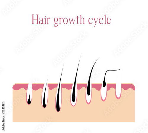 hair growth cycle. Hair loss. androgenetic Alopecia. Vector illustration