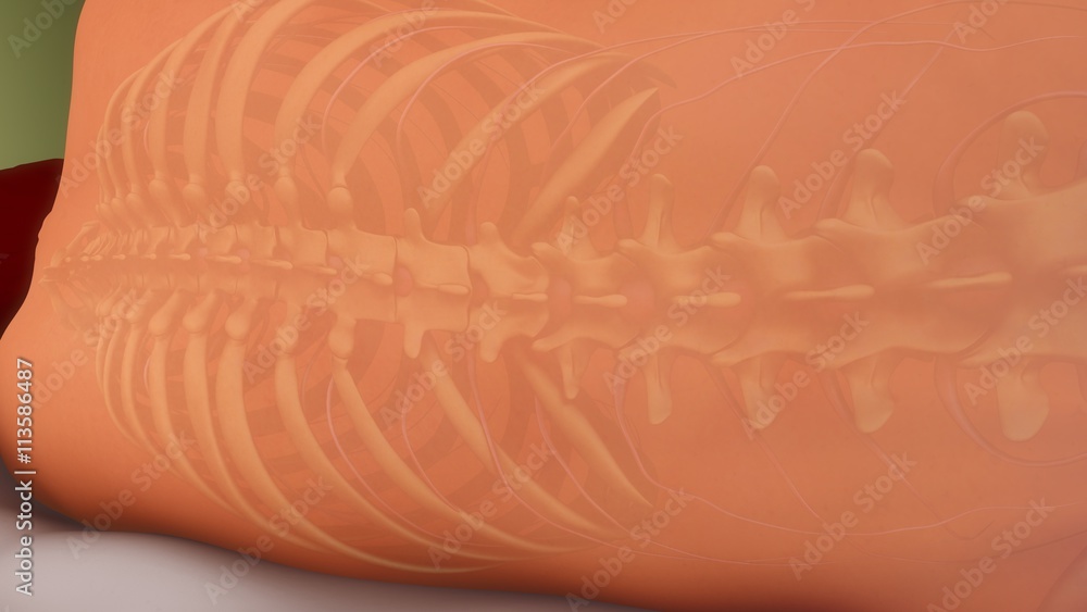 Spinal anesthesia Spinal anesthesia