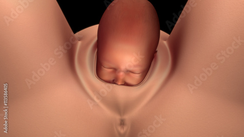 Normal labor and vaginal birth photo