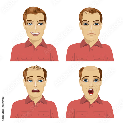 young man with different stages of hair loss