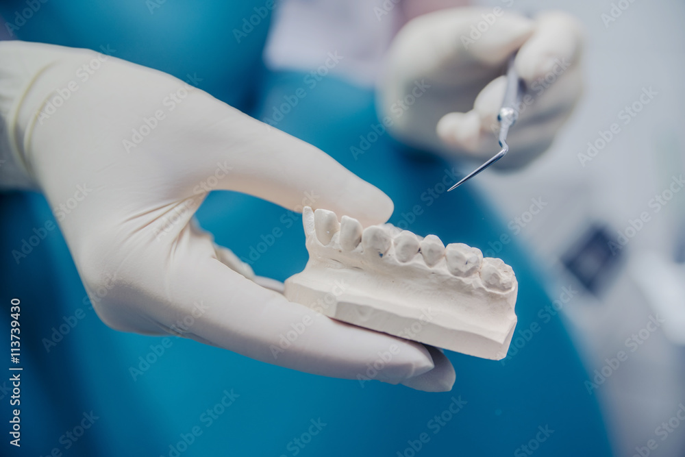 the impression of the denture in the hand of the dentist the impression of the denture in the hand of the dentist