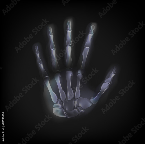 vector x-ray hand on black background.