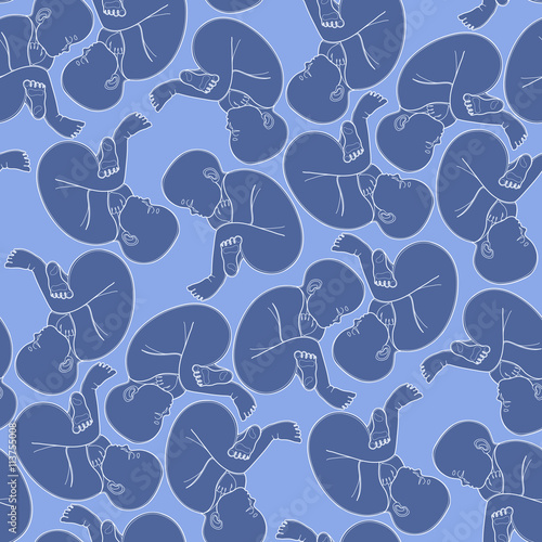 Graphic fetus pattern