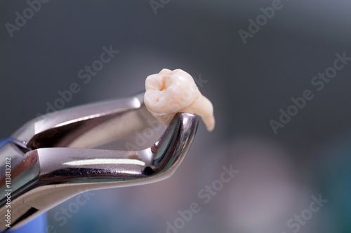 Dental equipment,tooth extraction photo