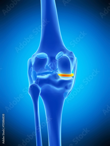 medically accurate illustration of the medial meniscus