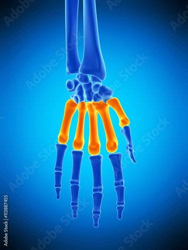 medically accurate illustration of the metacarpal bones photo