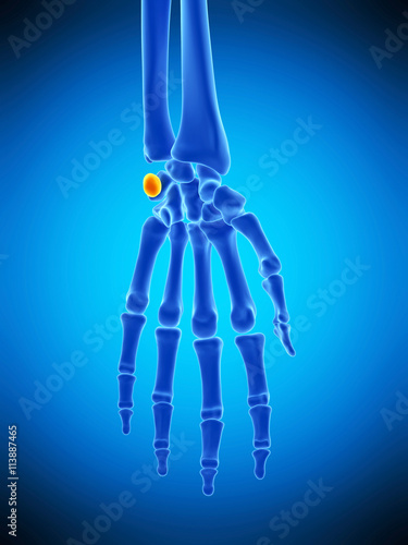 medically accurate illustration of the pisiform bone photo