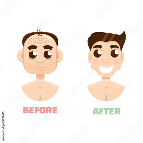 Plastic surgery man