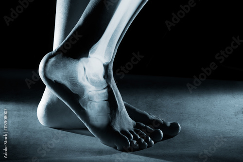 Human foot ankle and leg in x-ray photo