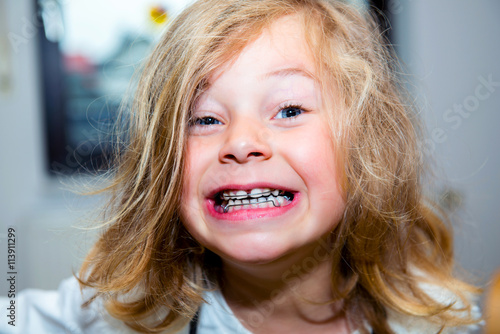 Photography little funny girl with retainer