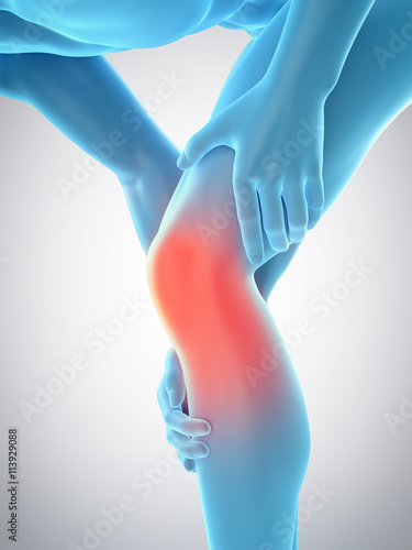 medically accurate 3d illustration of knee pain photo