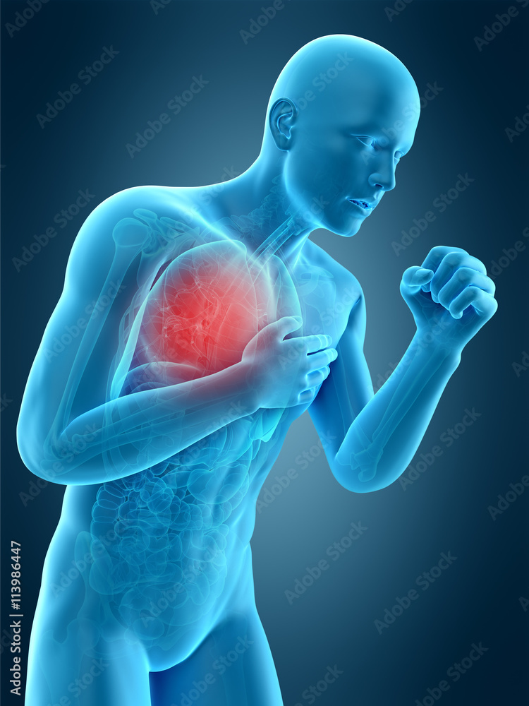 medically accurate 3d illustration of a coughing pose medically accurate 3d illustration of a coughing pose