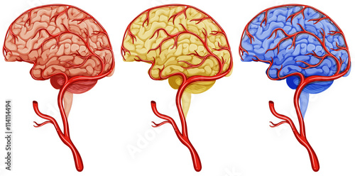 Brain cancer on white background