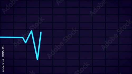 electrocardiogram (EKG or ECG) is a test that checks for problems with the electrical activity of your heart, loop