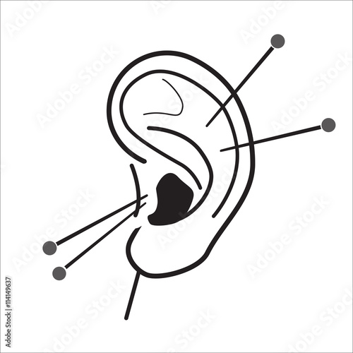 Human Ear acupuncture with needles vector illustration. Medical procedure illustration. Chinese Traditional, Alternative Medicine, Natural Healing and Recreation vector icon.