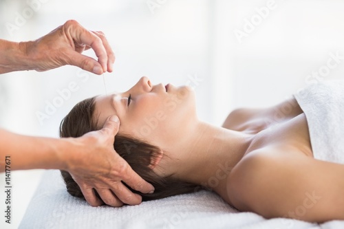 Woman receiving acupuncture treatment 