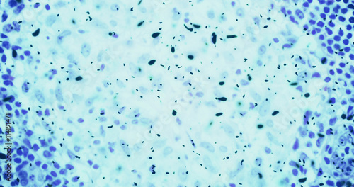 bacteria or germs microorganism cells under microscope in the color chemical blue fluid photo