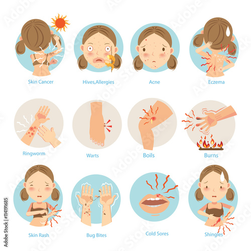 Skin Problems/Most people are a common skin problem.Vector  illustrations.