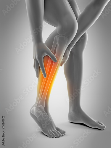 medically accurate 3d illustration of calf pain photo