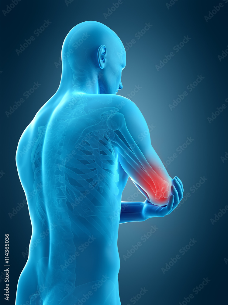 medically accurate 3d illustration of elbow pain medically accurate 3d illustration of elbow pain