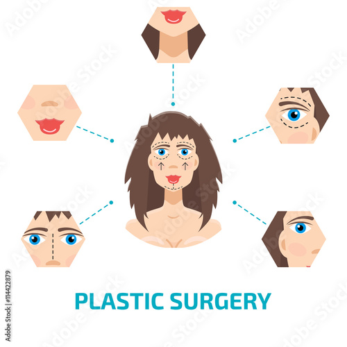 Plastic surgery infografic. Otoplasty, rhinoplasty